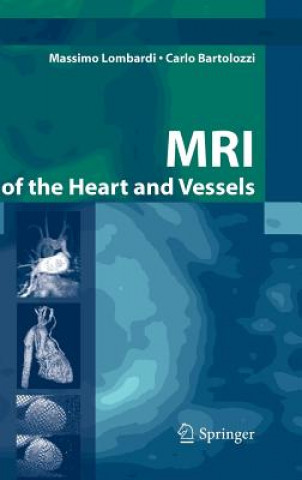 Книга MRI of the Heart and Vessels M. Lombardi