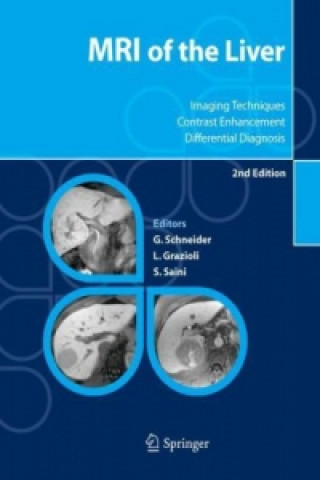 Kniha MRI of the Liver Günther Schneider