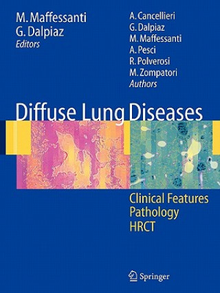 Könyv Diffuse Lung Diseases R. Polverosi