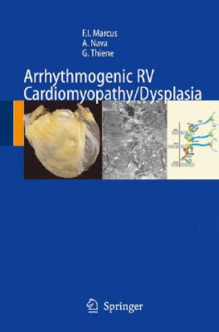 Carte Arrhythmogenic RV Cardiomyopathy/Dysplasia Frank I. Marcus