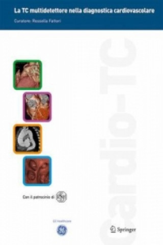 Книга La TC multidetettore nella diagnostica cardiovascolare, 4 Teile Rossella Fattori
