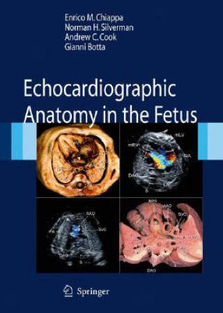 Книга Echocardiographic Anatomy in the Fetus Enrico Chiappa