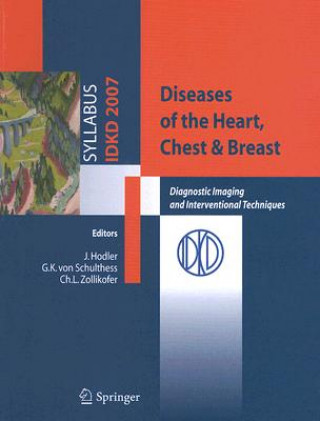 Carte Diseases of the Heart, Chest & Breast Jürg Hodler