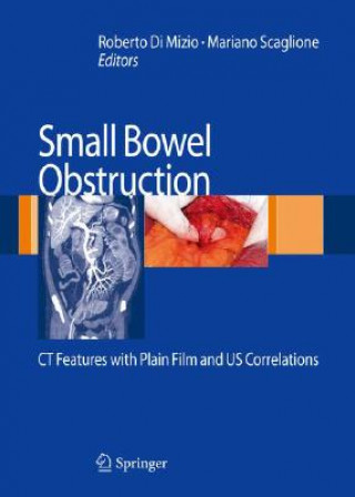 Książka Small-Bowel Obstruction Roberto Di Mizio