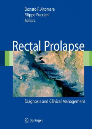 Carte Rectal Prolapse Donato Altomare