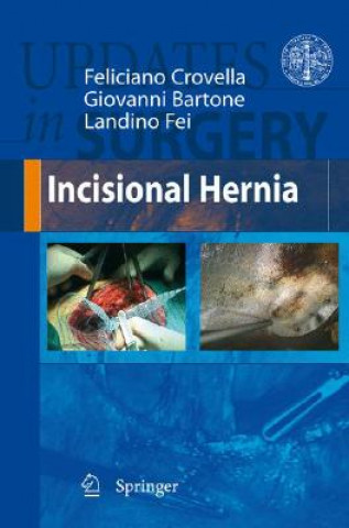 Knjiga Incisional Hernia Feliciano Crovella