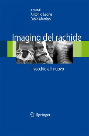 Kniha Imaging del rachide Antonio Leone
