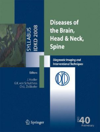 Knjiga Diseases of the Brain, Head & Neck, Spine Gustav K. von Schulthess