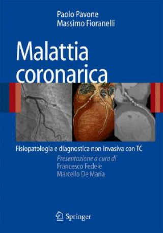 Kniha Malattia coronarica Paolo Pavone