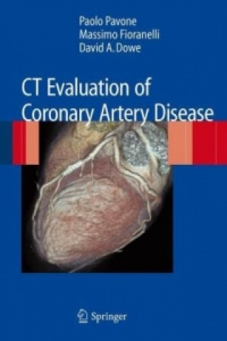 Könyv CT Evaluation of Coronary Artery Disease Paolo Pavone