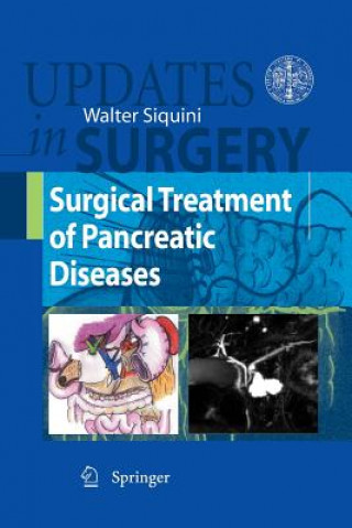 Kniha Surgical Treatment of Pancreatic Diseases Walter Siquini