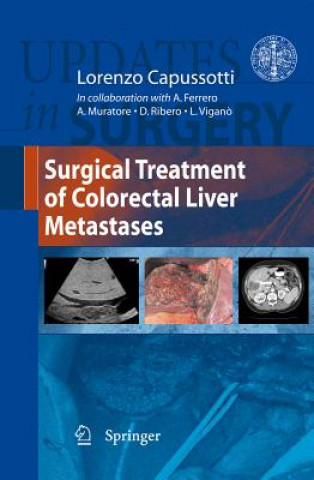 Carte Surgical Treatment of Colorectal Liver Metastases Lorenzo Capussotti