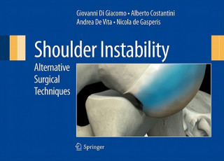 Książka Shoulder Instability Giovanni Di Giacomo