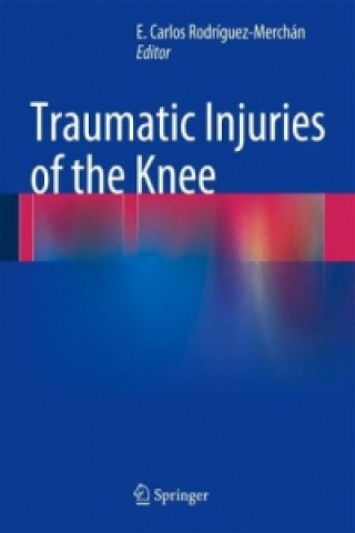 Knjiga Traumatic Injuries of the Knee E. Carlos Rodr