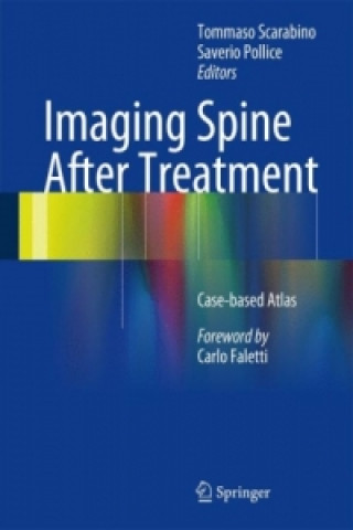 Kniha Imaging Spine After Treatment Tommaso Scarabino