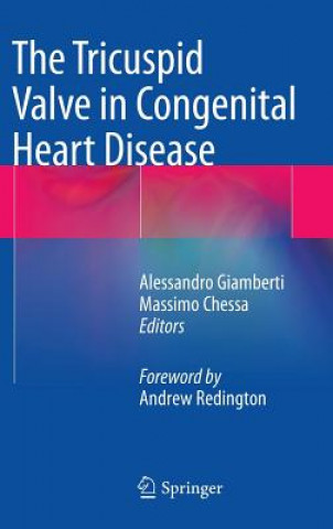 Kniha Tricuspid Valve in Congenital Heart Disease Alessandro Giamberti