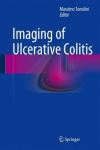 Carte Imaging of Ulcerative Colitis Massimo Tonolini