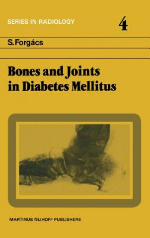 Carte Bones and Joints in Diabetes Mellitus S. Forgács