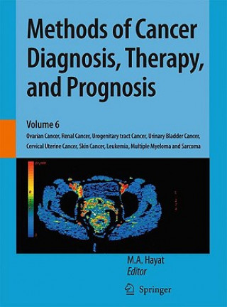 Carte Methods of Cancer Diagnosis, Therapy, and Prognosis M. A. Hayat