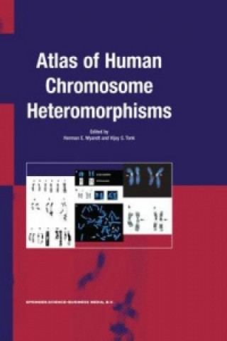 Könyv Atlas of Human Chromosome Heteromorphisms H.E. Wyandt