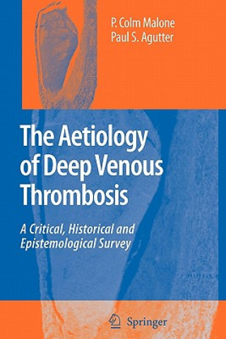 Buch The Aetiology of Deep Venous Thrombosis P. Colm Malone