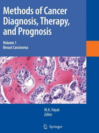 Könyv Methods of Cancer Diagnosis, Therapy and Prognosis M. A. Hayat