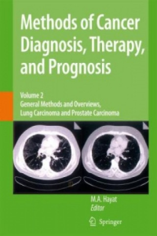 Kniha Methods of Cancer Diagnosis, Therapy and Prognosis M. A. Hayat
