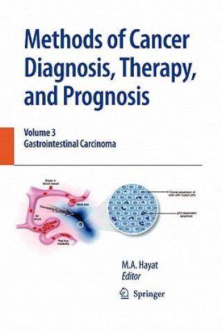 Carte Methods of Cancer Diagnosis, Therapy and Prognosis M. A. Hayat