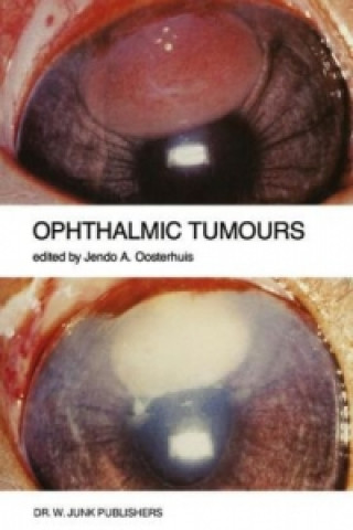 Carte Ophthalmic Tumours Jendo A. Oosterhuis