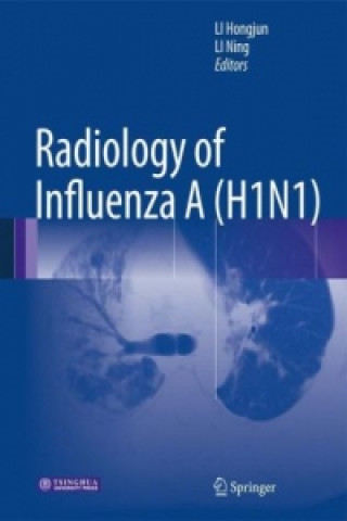 Kniha Radiology of Influenza A (H1N1) Hongjun Li