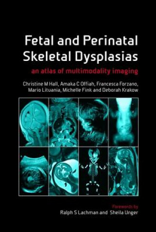 Carte Fetal and Perinatal Skeletal Dysplasias Christine M Hall