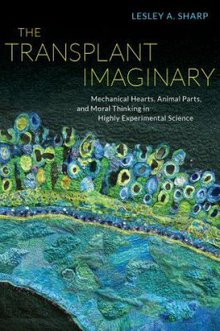 Könyv Transplant Imaginary Sharp
