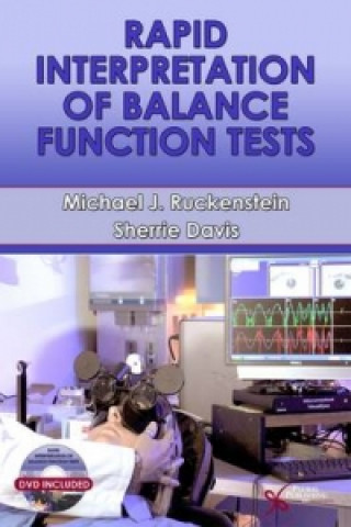 Книга Rapid Interpretation of Balance Function Tests Michael Ruckenstein