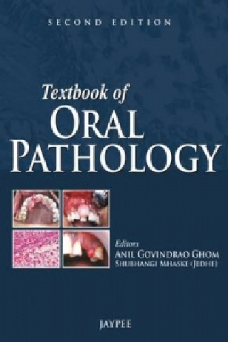 Книга Textbook of Oral Pathology Anil Govindrao Ghom