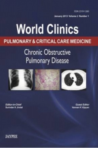 Libro World Clinics: Pulmonary & Critical Care Medicine - Chronic Obstructive Pulmonary Disease Surinder K Jindal