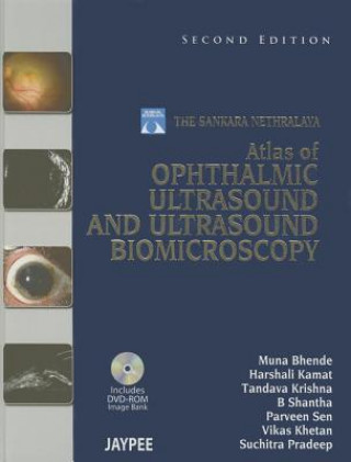 Buch Atlas of Ophthalmic Ultrasound and Ultrasound Biomicroscopy Muna Bhende