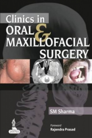 Könyv Clinics in Oral & Maxillofacial Surgery S M Sharma