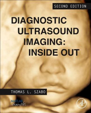 Kniha Diagnostic Ultrasound Imaging: Inside Out Thomas Szabo