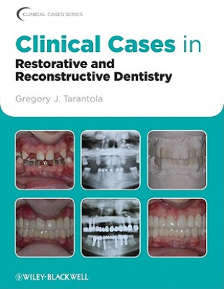 Carte Clinical Cases in Restorative and Reconstructive Dentistry Gregory J Tarantola