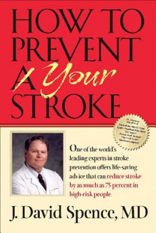 Könyv How to Prevent Your Stroke J David Spence