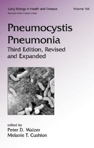 Kniha Pneumocystis Pneumonia Peter Walzer