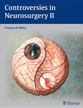 Könyv Controversies in Neurosurgery II Ossama Al- Mefty