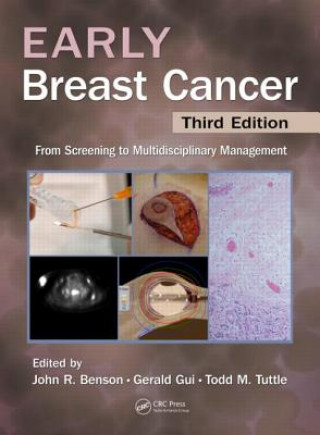 Carte Early Breast Cancer John R Benson