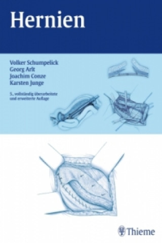 Könyv Hernien Volker Schumpelick