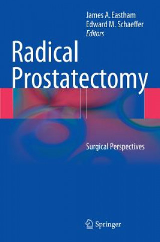 Knjiga Radical Prostatectomy James A. Eastham