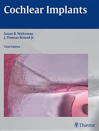 Könyv Cochlear Implants Susan B. Waltzman