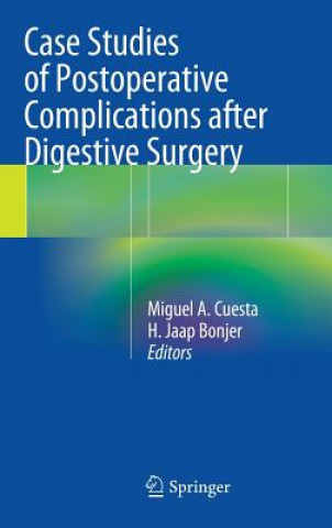 Kniha Case Studies of Postoperative Complications after Digestive Surgery Miguel A. Cuesta