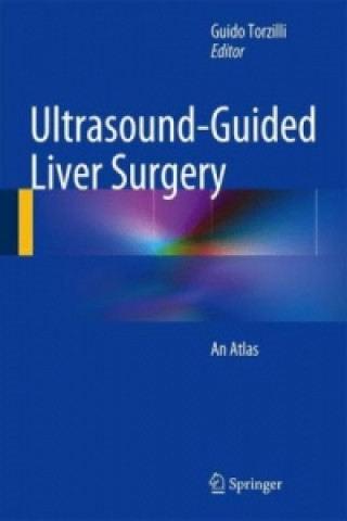 Kniha Ultrasound-Guided Liver Surgery Guido Torzilli