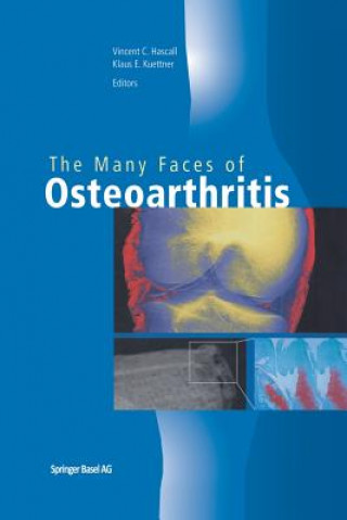 Kniha Many Faces of Osteoarthritis Vincent C. Hascall