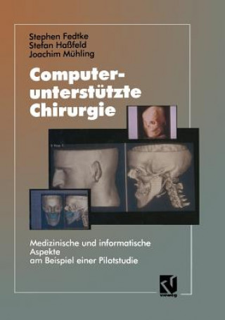 Book Computerunterstutzte Chirurgie Stephen Fedtke